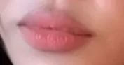Só oral