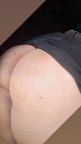 Mel  379904