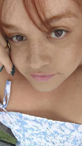 Raposinha  389174
