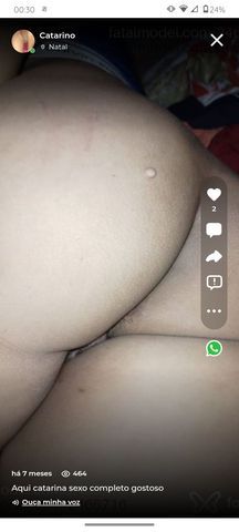 Aqui Catarina massoterapeuta massagem com finalização bb tudo completo meu anjo tenho 41 anos   sou morena cabelos curtos bumbum grande bb coxas também sou gostosa sou muito carinhosa meu anjo sou tranquila não tenho frescura bb vamos marcar um horário 